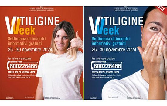 La ‘Vitiligine Week’ arriva in Sicilia: incontri gratuiti con i dermatologi